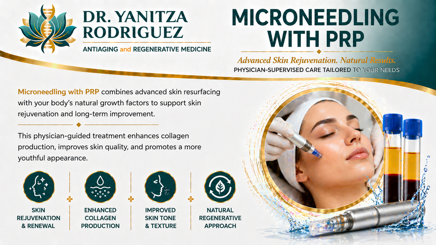 Microneedling with PRP skin rejuvenation treatment illustration